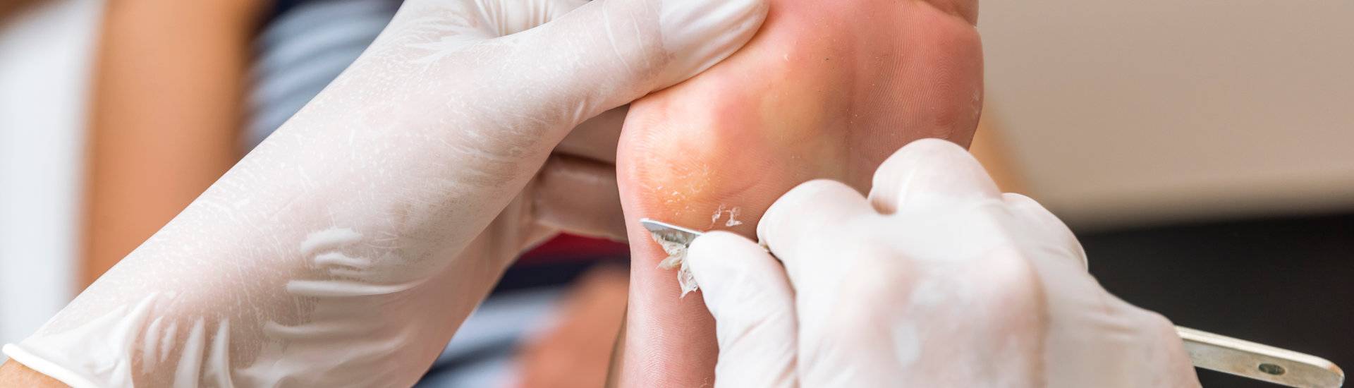 Podologie Düsseldorf, Fußsohlen, Diabetesfußpflege, Zehennagelpflege, Seniorenfußpflege, Fußhygiene